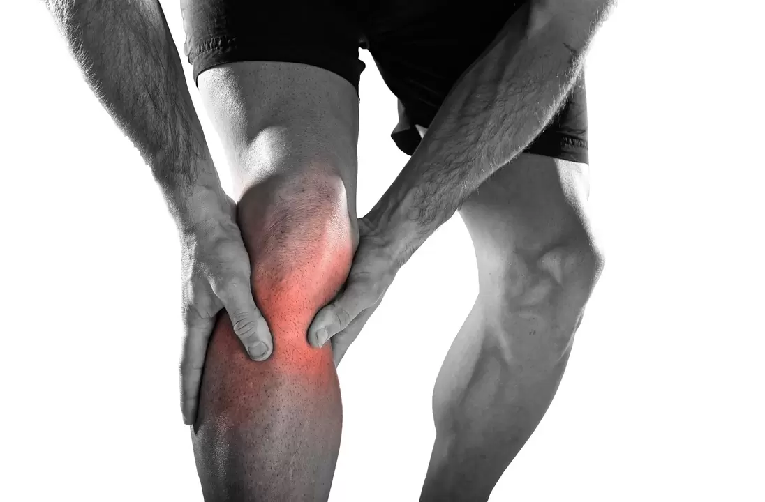 Inflammation de l'articulation du genou et son traitement avec le spray Hondro Sol. 