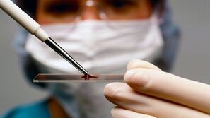 Diagnostic d'arthrose et d'arthrose
