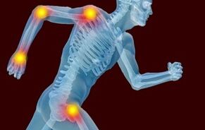 Les raisons du développement de l'arthrose et de l'arthrose