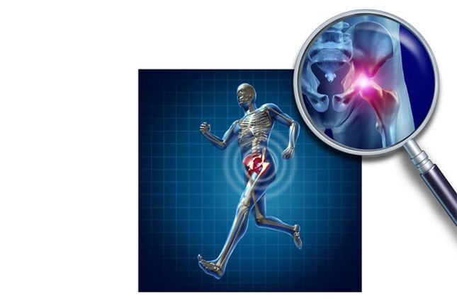 Douleur lors de la course dans l'articulation de la hanche